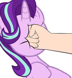 Size: 894x965 | Tagged: safe, imported from derpibooru, starlight glimmer, human, pony, unicorn, abuse, abusive human, background pony strikes again, drama, drama bait, duo, edgy, female, glimmerbuse, mare, op is a duck, op is trying to start shit, punch, simple background, starlight drama, white background